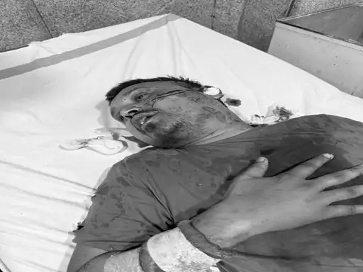 Raipur Central Jail : जेल में बंद कांग्रेसी नेता आशीष शिंदे पर जानलेवा हमला