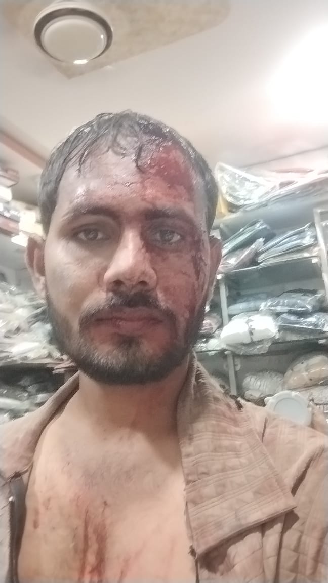 Criminals Under Police Protection : लहूलुहान कारोबारी के हमलावरों को मुजगहन थाना पुलिस ने छोड़ा !