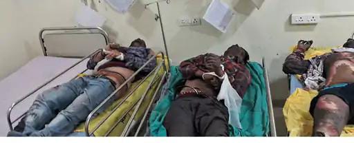 Accident In Steel Factory : स्टील फैक्ट्री में 6 कर्मचारियों की मौत, 6 झुलसे, 2 गंभीर