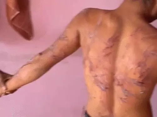 Department of Social Welfare, Chhattisgarh :  नशा मुक्ति केंद्र ‘साहस’ बन गया टॉर्चर सेल