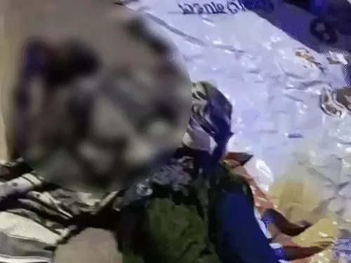 Police Commissionerate Raipur :  बॉयफ्रेंड ने बीच सड़क गर्लफ्रेंड को पेट्रोल डालकर जिंदा जलाया, मौत